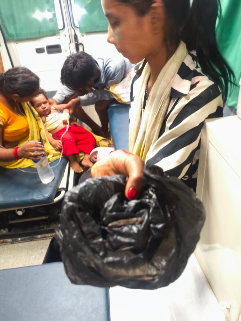 देवरिया में हैरान करने वाला मामला: 18 माह के बच्चे ने सांप के बच्चे को मुंह में लेकर काटा, हालत गंभीर
