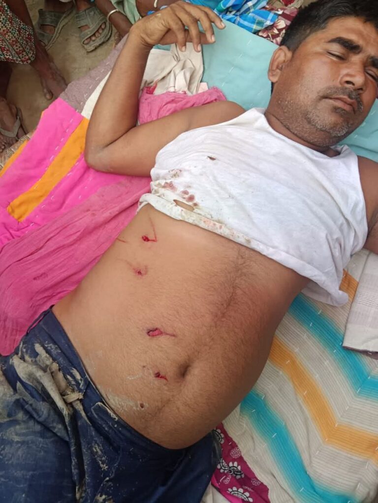 बहराइच में तेंदुए का आतंक: खेत में काम कर रहे किसान पर हमला, गंभीर घायल
