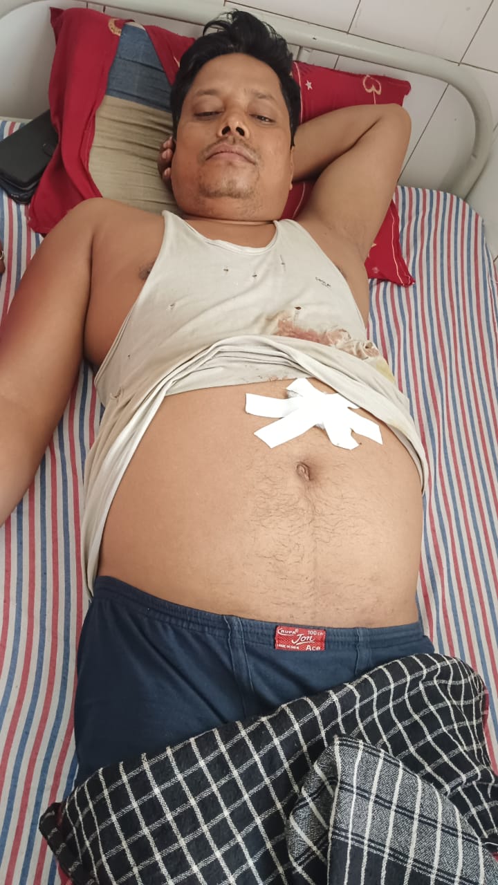 जमीन के रास्ते पर भड़का खून का खेल: देवरिया में ताबड़तोड़ चाकू वार से युवक की मौत, गांव में तनाव