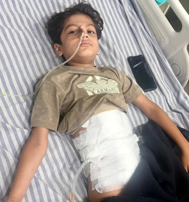 मीरापुर में बंदरों के आतंक से बड़ा हादसा, छत से गिरे छह वर्षीय मासूम के पेट में घुसा सरिया, ऑपरेशन के बाद हालत स्थिर