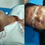 खतौली में सड़क पर मौत बनकर आया सांड, बाइक से जोरदार टक्कर; दो युवक गंभीर घायल