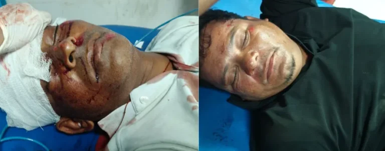 खतौली में सड़क पर मौत बनकर आया सांड, बाइक से जोरदार टक्कर; दो युवक गंभीर घायल