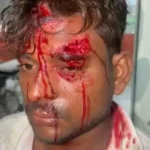 मुजफ्फरनगर में ₹94 हजार के बकाये का तकादा पड़ा भारी: पेंट की दुकान पर चढ़कर मारपीट, हथियार लहराकर धमकी; परवेज गंभीर