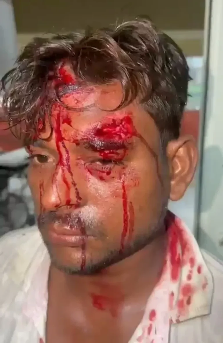 मुजफ्फरनगर में ₹94 हजार के बकाये का तकादा पड़ा भारी: पेंट की दुकान पर चढ़कर मारपीट, हथियार लहराकर धमकी; परवेज गंभीर