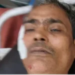 खतौली में सड़क हादसों का दिन, दो दुर्घटनाओं में छह बाइक सवार घायल; तीन की हालत गंभीर