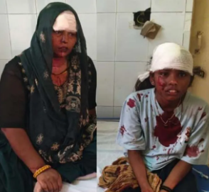 भोपा में रफ्तार का कहर: ट्रक ने ई-रिक्शा को मारी भीषण टक्कर, महिला की मौत; 3 बच्चों समेत 7 घायल