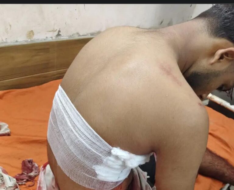 देवरिया में पानी के छींटे पड़ने के विवाद में युवक को चाकू मारा, मेडिकल कॉलेज रेफर; दो आरोपी हिरासत में