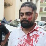 मीरापुर में रुपये के विवाद ने लिया खूनी रूप: संभलहेड़ा फ्लाईओवर पर गुलफाम को घेरकर जानलेवा हमला, सिर में गहरी चोट