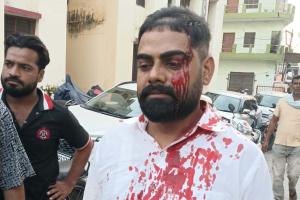 मीरापुर में रुपये के विवाद ने लिया खूनी रूप: संभलहेड़ा फ्लाईओवर पर गुलफाम को घेरकर जानलेवा हमला, सिर में गहरी चोट