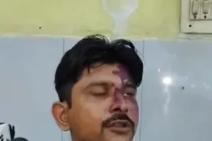 मुजफ्फरनगर में पेड़ बेचने के पैसों पर पति-पत्नी में संग्राम! मारपीट का वीडियो वायरल, दोनों ने एक-दूसरे पर लगाए आरोप